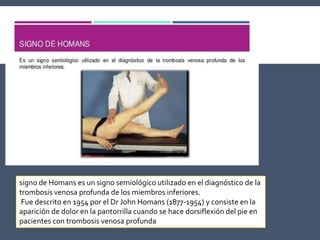signo de Homans es un signo semiológico utilizado en el diagnóstico de la
trombosis venosa profunda de los miembros inferiores.
Fue descrito en 1954 por el Dr John Homans (1877-1954) y consiste en la
aparición de dolor en la pantorrilla cuando se hace dorsiflexión del pie en
pacientes con trombosis venosa profunda
 