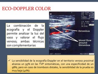 ECO-DOPPLER COLOR
.
 La sensibilidad de la ecografía-Doppler en el territorio venoso proximal
alcanza un 95% en las TVP sintomáticas, con una especificidad de un
98%; pero en caso de trombosis distales, la sensibilidad de la prueba es
muy baja (40%).
La combinación de la
ecografía y el Doppler
permite analizar la luz del
vaso y valorar el flujo
venoso; ambas técnicas
son complementarias
 