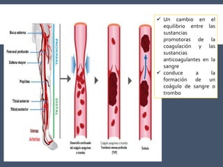  Un cambio en el
equilibrio entre las
sustancias
promotoras de la
coagulación y las
sustancias
anticoagulantes en la
sangre
 conduce a la
formación de un
coágulo de sangre o
trombo
 