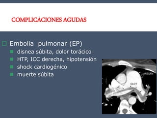 COMPLICACIONES AGUDAS
 Embolia pulmonar (EP)
 disnea súbita, dolor torácico
 HTP, ICC derecha, hipotensión
 shock cardiogénico
 muerte súbita
 