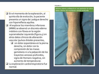  En el momento de la exploración, al
quinto día de evolución, la paciente
presenta un signo de Lasègue derecho
con hiporreflexia aquílea.
 Al explorar los miembros inferiores
(MMII) se observó un discreto edema
indoloro con fóvea en la región
supramaleolar izquierda (figura 4) sin
otros datos clínicos de alteración
vascular (pulsos distales presentes,
 sin dolor espontáneo en la pierna
derecha, sin dolor con la
compresión de las masas
gemelares ni a la palpación de los
trayectos venosos profundos,
signo de Homans negativo, sin
aumento de temperatura).
 La exploración cardiorrespiratoria fue
normal.
 