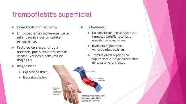Las causas de la formación de las venas en los pies