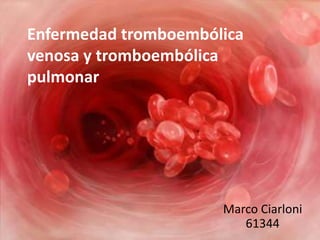 Enfermedad tromboembólica
venosa y tromboembólica
pulmonar




                      Marco Ciarloni
                         61344
 