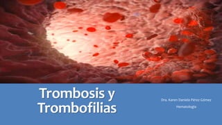 Trombosis y
Trombofilias
Dra. Karen Daniela Pérez Gómez
Hematologia
 