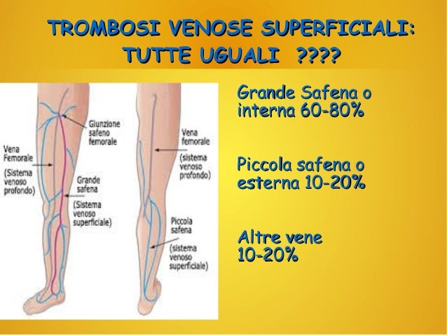 Linfiammazione di vene che stanno che trattare