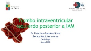 Trombo intraventricular
izquierdo posterior a IAM
Dr. Francisco González Nome
Becado Medicina Interna
Cardiología
Marzo 2022
 
