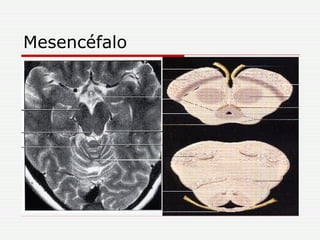 Mesencéfalo 