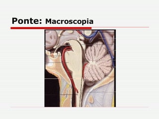 Ponte:  Macroscopia 
