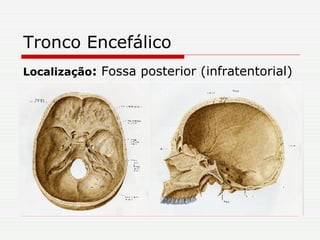 Tronco Encefálico Localização :  Fossa posterior (infratentorial) 