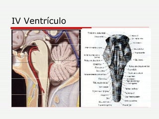 IV Ventrículo 