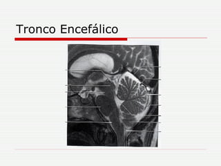 Tronco Encefálico 