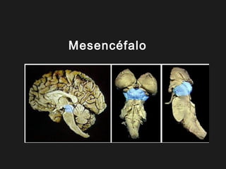 Mesencéfalo
 