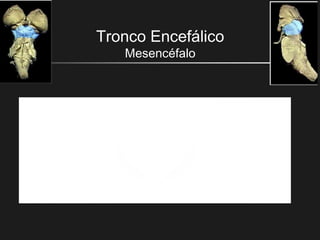 Tronco Encefálico
Mesencéfalo
 
