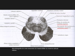 Microfotografia de corte transverso do mesencéfalo no nível do colículo
inferior.
 