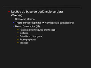  Lesões da base do pedúnculo cerebral
(Weber)
Síndrome alterna

Tracto córtico-espinhal  Hemiparesia contralateral

Nervo óculomotor (M)
 Paralisia dos músculos extrínsecos
 Diplopia
 Estrabismo divergente
 Ptose palpebral
 Midríase
 