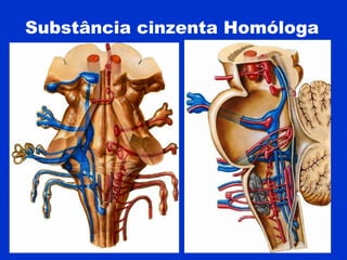 Substância cinzenta Homóloga
 