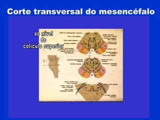 Corte transversal do mesencéfalo
 