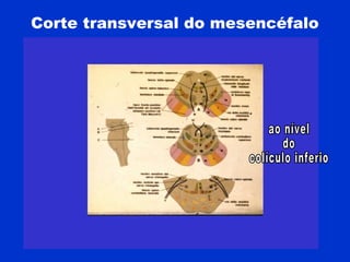 Corte transversal do mesencéfalo
 