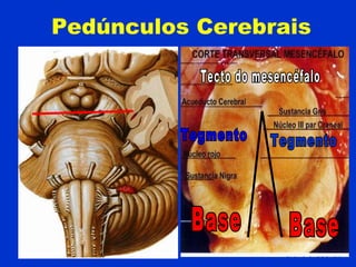 Pedúnculos Cerebrais
 