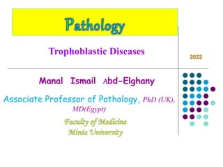 Manal Ismail Abd-Elghany
Associate Professor of Pathology, PhD (UK),
MD(Egypt)
Trophoblastic Diseases
 