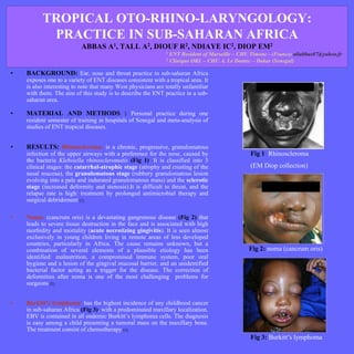 TROPICAL OTO-RHINO-LARYNGOLOGY:
           PRACTICE IN SUB-SAHARAN AFRICA
                          ABBAS       A1,   TALL    A2,   DIOUF     R 2,   NDIAYE   IC2,   DIOP    EM 2
                                                              1 ENT Resident of Marseille – CHU Timone - (France) aliabbas07@yahoo.fr
                                                              2 Clinique ORL – CHU A. Le Dantec – Dakar (Senegal)


•   BACKGROUND: Ear, nose and throat practice in sub-saharan Africa
    exposes one to a variety of ENT diseases consistent with a tropical area. It
    is also interesting to note that many West physicians are totally unfamiliar
    with them. The aim of this study is to describe the ENT practice in a sub-
    saharan area.

•   MATERIAL AND METHODS : Personal practice during one
    resident semester of training in hospitals of Senegal and meta-analysis of
    studies of ENT tropical diseases.


•   RESULTS: Rhinoscleroma: is a chronic, progressive, granulomatous
    infection of the upper airways with a preference for the nose, caused by                    Fig 1: Rhinoscleroma
    the bacteria Klebsiella rhinoscleromatis (Fig 1). It is classified into 3
    clinical stages: the catarrhal-atrophic stage (atrophy and crusting of the                  (EM Diop collection)
    nasal mucosa), the granulomatous stage (rubbery granulomatous lesion
    evolving into a pale and indurated granulomatous mass) and the sclerotic
    stage (increased deformity and stenosis).It is difficult to threat, and the
    relapse rate is high: treatment by prolonged antimicrobial therapy and
    surgical debridement [1].

•   Noma: (cancrum oris) is a devastating gangrenous disease (Fig 2) that
    leads to severe tissue destruction in the face and is associated with high
    morbidity and mortality (acute necrotizing gingivitis). It is seen almost
    exclusively in young children living in remote areas of less developed
    countries, particularly in Africa. The cause remains unknown, but a
    combination of several elements of a plausible etiology has been                           Fig 2: noma (cancrum oris)
    identified: malnutrition, a compromised immune system, poor oral
    hygiene and a lesion of the gingival mucosal barrier, and an unidentified
    bacterial factor acting as a trigger for the disease. The correction of
    deformities after noma is one of the most challenging problems for
    surgeons [2].


•   Burkitt’s lymphoma: has the highest incidence of any childhood cancer
    in sub-saharan Africa (Fig 3), with a predominated maxillary localization.
    EBV is contained in all endemic Burkitt’s lymphoma cells. The diagnosis
    is easy among a child presenting a tumoral mass on the maxillary bone.
    The treatment consist of chemotherapy [3].
                                                                                                Fig 3: Burkitt’s lymphoma
 