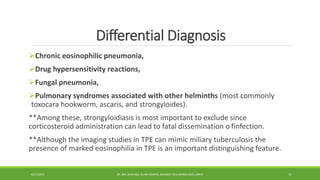 Differential Diagnosis
Chronic eosinophilic pneumonia,
Drug hypersensitivity reactions,
Fungal pneumonia,
Pulmonary syndromes associated with other helminths (most commonly
toxocara hookworm, ascaris, and strongyloides).
**Among these, strongyloidiasis is most important to exclude since
corticosteroid administration can lead to fatal dissemination o finfection.
**Although the imaging studies in TPE can mimic miliary tuberculosis the
presence of marked eosinophilia in TPE is an important distinguishing feature.
4/27/2023 DR. MD. SHAFIQUL ISLAM DEWAN, RESIDENT (PULMONOLOGY), DMCH 11
 