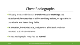 Chest Radiographs
Usually increased bilateral bronchovascular markings and
reticulonodular opacities or diffuse miliary lesions, or opacities in
the middle and lower lung fields.
Cavitation, bronchiectasis, and pleural effusion have been
reported but are uncommon;
Chest radiographs may also be normal.
4/27/2023 DR. MD. SHAFIQUL ISLAM DEWAN, RESIDENT (PULMONOLOGY), DMCH 9
 