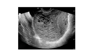 Tropoblastic diseases