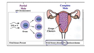 Tropoblastic diseases