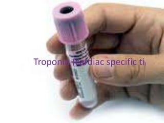 Troponin (cardiac specific ti)
 