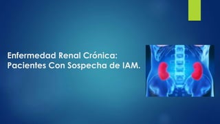 Enfermedad Renal Crónica:
Pacientes Con Sospecha de IAM.
 