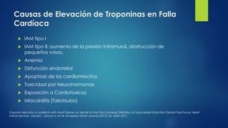 Causas de Elevación de Troponinas en Falla
Cardíaca
 IAM tipo I
 IAM tipo II: aumento de la presión intramural, obstrucc...