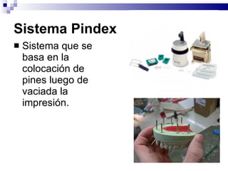 Sistema Pindex Sistema que se basa en la colocación de pines luego de vaciada la impresión. 