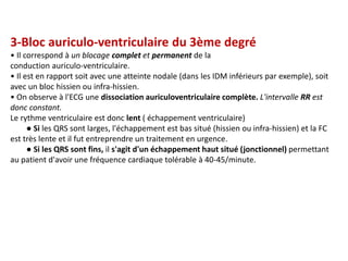 3-Bloc auriculo-ventriculaire du 3ème degré
• Il correspond à un blocage complet et permanent de la
conduction auriculo-ventriculaire.
• Il est en rapport soit avec une atteinte nodale (dans les IDM inférieurs par exemple), soit
avec un bloc hissien ou infra-hissien.
• On observe à l'ECG une dissociation auriculoventriculaire complète. L'intervalle RR est
donc constant.
Le rythme ventriculaire est donc lent ( échappement ventriculaire)
● Si les QRS sont larges, l'échappement est bas situé (hissien ou infra-hissien) et la FC
est très lente et il fut entreprendre un traitement en urgence.
● Si les QRS sont fins, il s'agit d'un échappement haut situé (jonctionnel) permettant
au patient d'avoir une fréquence cardiaque tolérable à 40-45/minute.
 