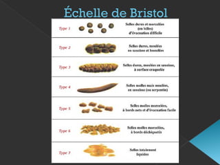 Échelle de Bristol
 