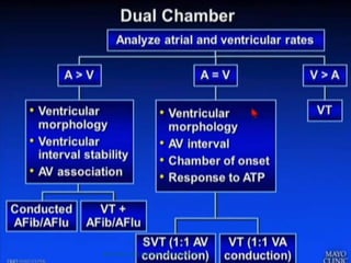 TROUBLE SHOOTING OF ICD & CRT
 