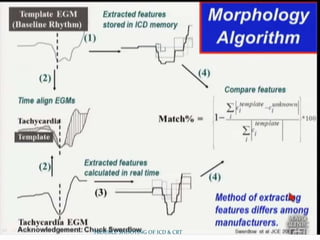 TROUBLE SHOOTING OF ICD & CRT
 