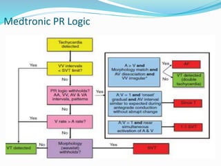 Medtronic PR Logic
 