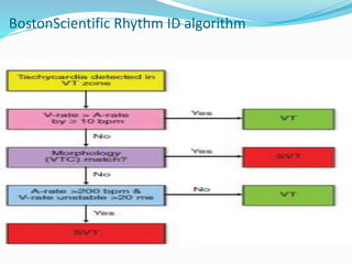 BostonScientific Rhythm ID algorithm
 