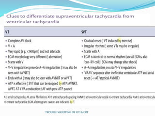 TROUBLE SHOOTING OF ICD & CRT
 