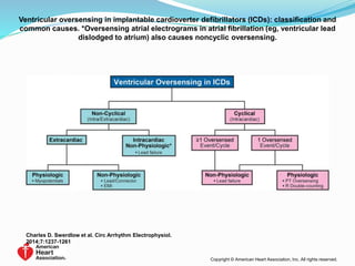 Ventricular oversensing in implantable cardioverter defibrillators (ICDs): classification and
common causes. *Oversensing atrial electrograms in atrial fibrillation (eg, ventricular lead
dislodged to atrium) also causes noncyclic oversensing.
Charles D. Swerdlow et al. Circ Arrhythm Electrophysiol.
2014;7:1237-1261
Copyright © American Heart Association, Inc. All rights reserved.
 