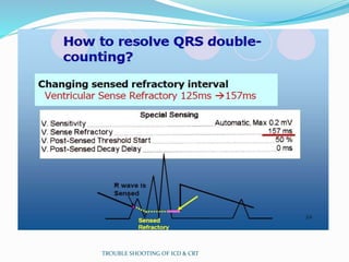 TROUBLE SHOOTING OF ICD & CRT
 