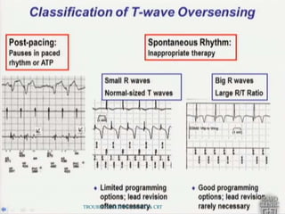 TROUBLE SHOOTING OF ICD & CRT
 