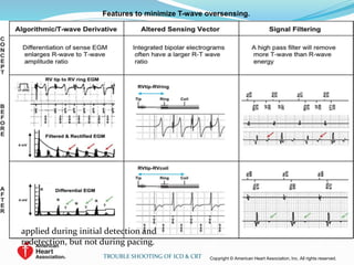 Features to minimize T-wave oversensing.
Copyright © American Heart Association, Inc. All rights reserved.TROUBLE SHOOTING OF ICD & CRT
applied during initial detection and
redetection, but not during pacing.
 