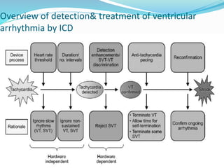 Overview of detection& treatment of ventricular
arrhythmia by ICD
 