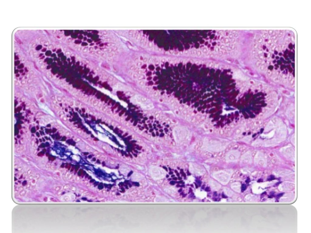 Troubleshooting in H&E Staining