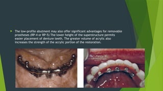  The low-profile abutment may also offer significant advantages for removable
prostheses (RP-4 or RP-5) The lower height of the superstructure permits
easier placement of denture teeth. The greater volume of acrylic also
increases the strength of the acrylic portion of the restoration.
 