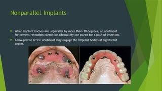 Nonparallel Implants
 When implant bodies are unparallel by more than 30 degrees, an abutment
for cement retention cannot be adequately pre pared for a path of insertion.
 A low-profile screw abutment may engage the implant bodies at significant
angles.
 
