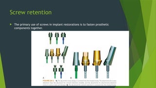Screw retention
 The primary use of screws in implant restorations is to fasten prosthetic
components together.
 
