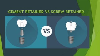 CEMENT RETAINED VS SCREW RETAINED
 